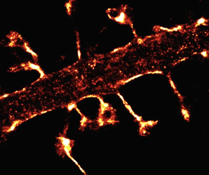 Super-resolution fluorescence imaging – Institut Langevin project using Prophesee Event-Based Vision Super-resolution fluorescence imaging – Institut Langevin project using Prophesee Event-Based Vision