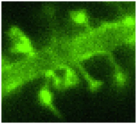 Conventional fluorescence image of the cytoskeleton, about 250 nm resolution