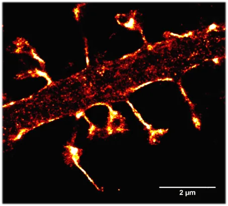 Super-resolved single-molecule localization image of the cytoskeleton, about 25 nm resolution